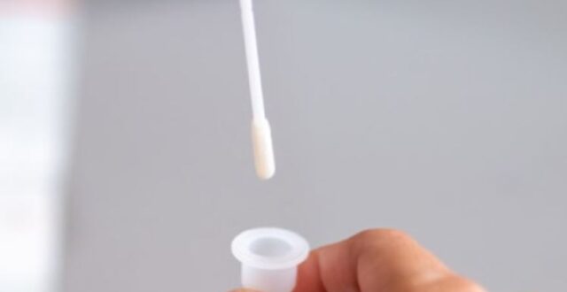 COVID-19 test